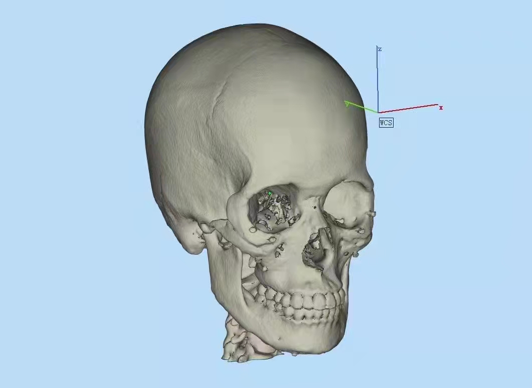 3D打印